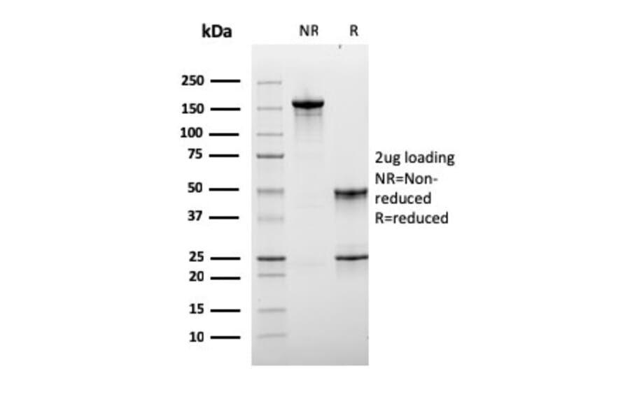 SDS-PAGE - Anti-Lymphocyte Activation Gene 3 Antibody [LAG3/3261] (A249221) - Antibodies.com