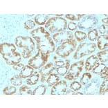 Immunohistochemistry - Anti-Laminin gamma 1 Antibody [SPM193] (A249222) - Antibodies.com