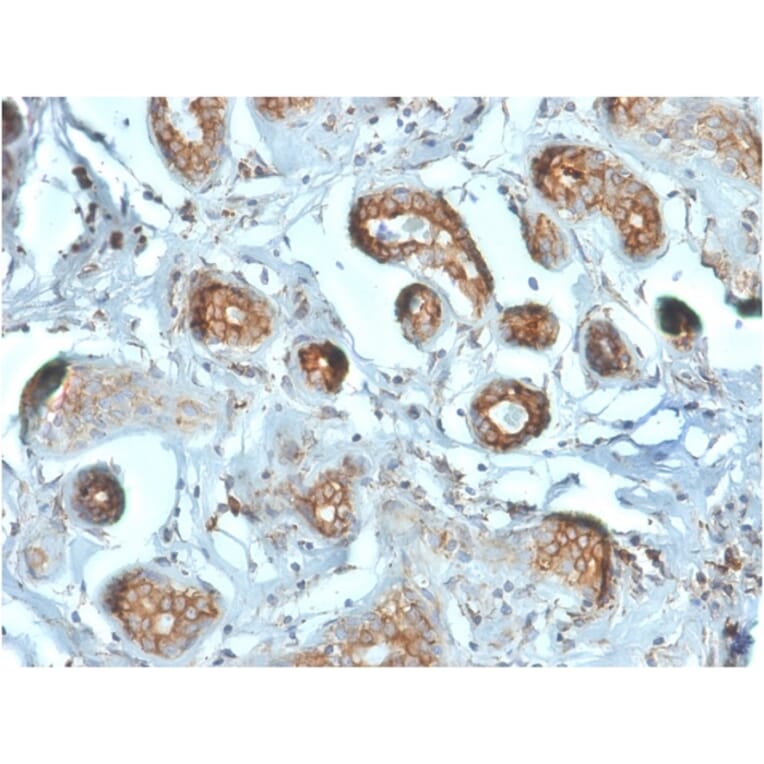 Immunohistochemistry - Anti-67kDa Laminin Receptor Antibody [RPSA/2699] (A249224) - Antibodies.com