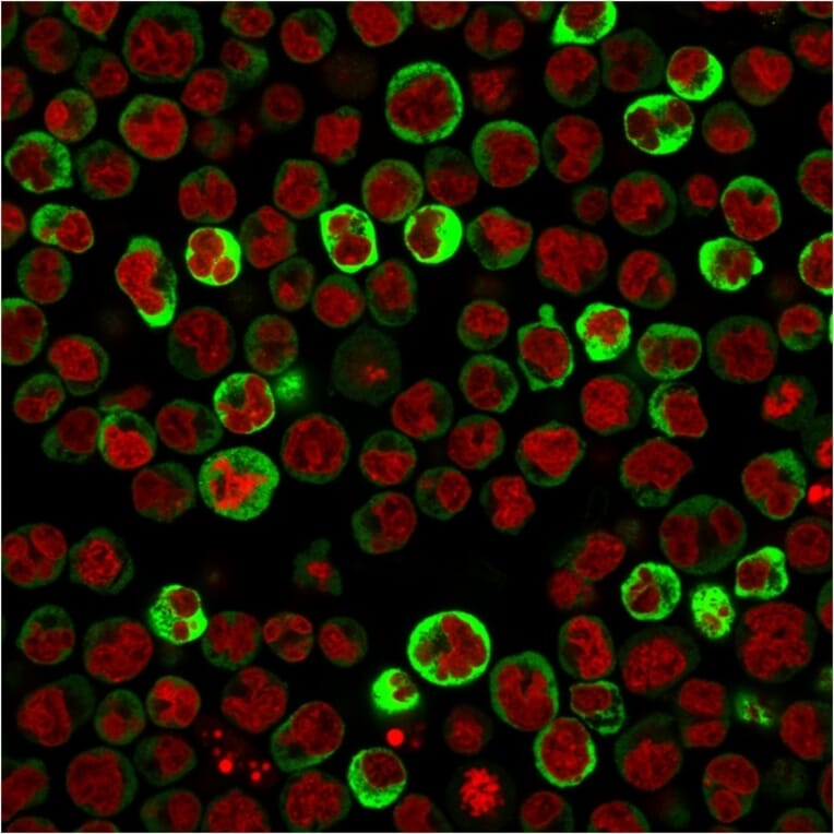 Immunofluorescence - Anti-67kDa Laminin Receptor Antibody [RPSA/2699] (A249224) - Antibodies.com