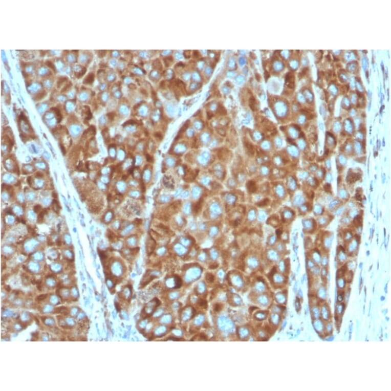 Immunohistochemistry - Anti-67kDa Laminin Receptor Antibody [RPSA/2699] (A249224) - Antibodies.com