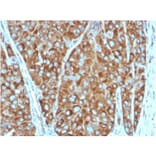 Immunohistochemistry - Anti-67kDa Laminin Receptor Antibody [RPSA/2699] (A249224) - Antibodies.com