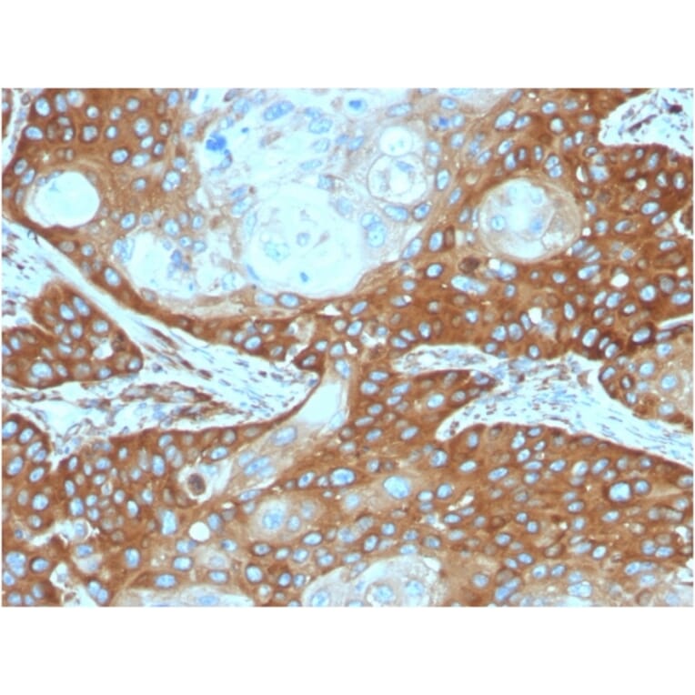 Immunohistochemistry - Anti-67kDa Laminin Receptor Antibody [RPSA/2699] (A249224) - Antibodies.com