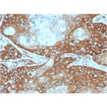Immunohistochemistry - Anti-67kDa Laminin Receptor Antibody [RPSA/2699] (A249224) - Antibodies.com