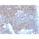 Immunohistochemistry - Anti-67kDa Laminin Receptor Antibody [RPSA/2699] (A249224) - Antibodies.com