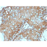 Immunohistochemistry - Anti-67kDa Laminin Receptor Antibody [RPSA/2699] (A249224) - Antibodies.com