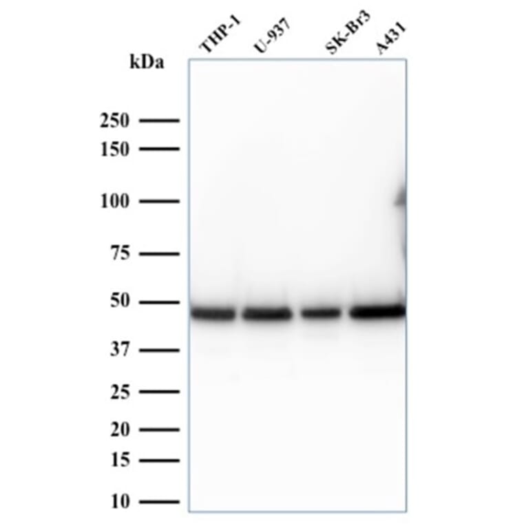 Western Blot - Anti-67kDa Laminin Receptor Antibody [RPSA/2699] (A249224) - Antibodies.com
