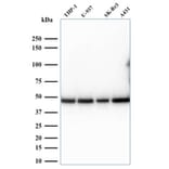 Western Blot - Anti-67kDa Laminin Receptor Antibody [RPSA/2699] (A249224) - Antibodies.com