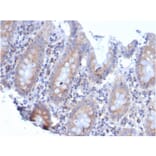Immunohistochemistry - Anti-67kDa Laminin Receptor Antibody [rRPSA/6333] (A249225) - Antibodies.com
