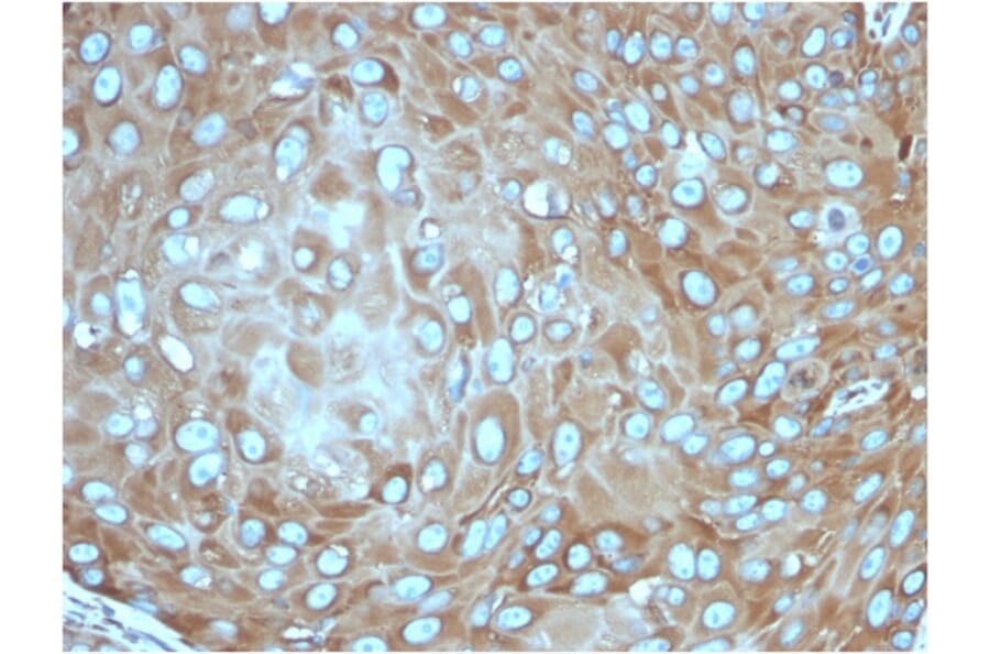 Immunohistochemistry - Anti-67kDa Laminin Receptor Antibody [rRPSA/6333] (A249225) - Antibodies.com
