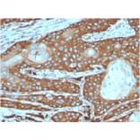 Immunohistochemistry - Anti-67kDa Laminin Receptor Antibody [rRPSA/6333] (A249224) - Antibodies.com