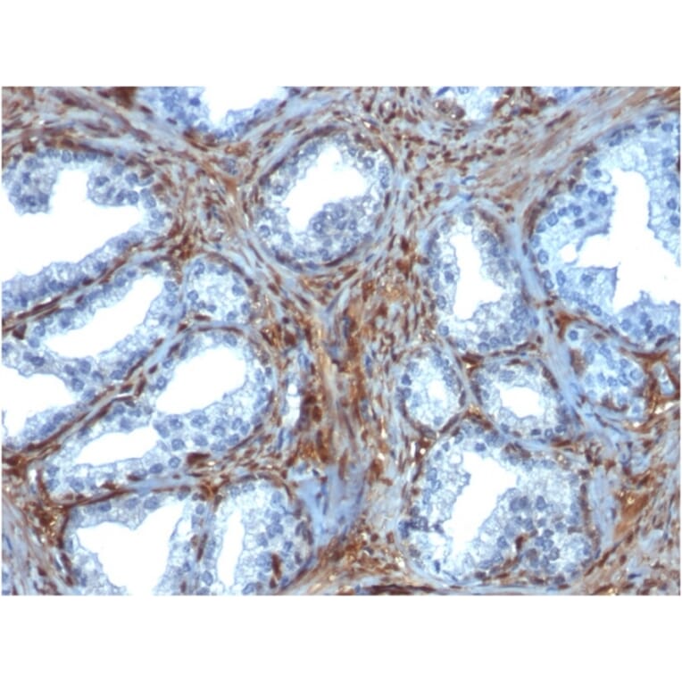 Immunohistochemistry - Anti-Galectin 1 Antibody [GAL1/1831] (A249226) - Antibodies.com