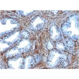 Immunohistochemistry - Anti-Galectin 1 Antibody [GAL1/1831] (A249226) - Antibodies.com