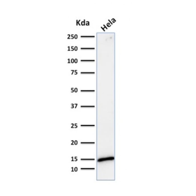 Western Blot - Anti-Galectin 1 Antibody [GAL1/1831] (A249226) - Antibodies.com