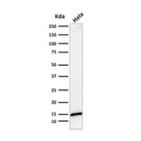 Western Blot - Anti-Galectin 1 Antibody [GAL1/1831] (A249226) - Antibodies.com