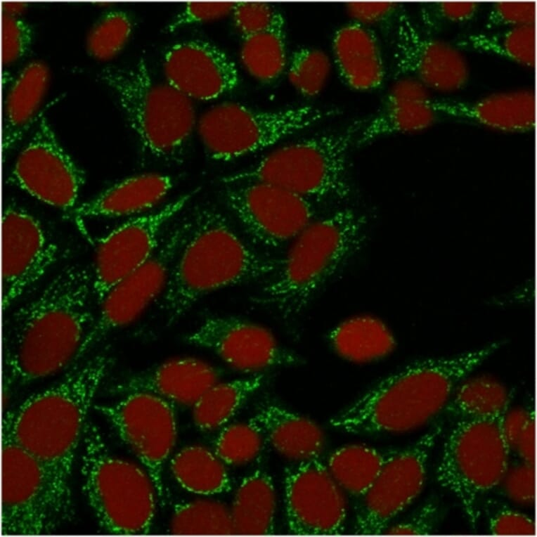 Immunofluorescence - Anti-Galectin 1 Antibody [GAL1/1831] (A249226) - Antibodies.com