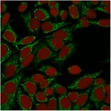 Immunofluorescence - Anti-Galectin 1 Antibody [GAL1/1831] (A249226) - Antibodies.com