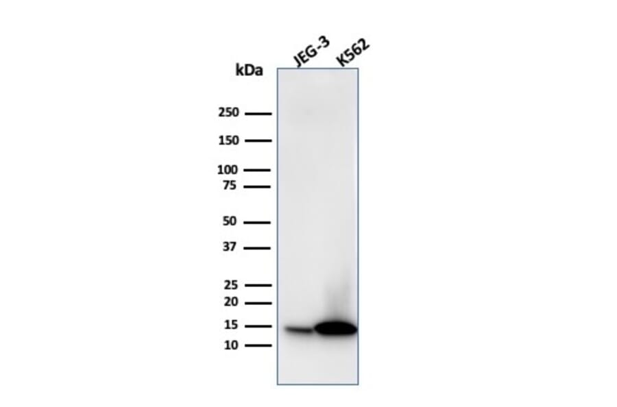 Western Blot - Anti-Galectin 1 Antibody [GAL1/1831] (A249226) - Antibodies.com
