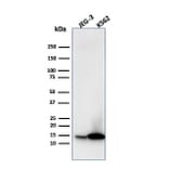 Western Blot - Anti-Galectin 1 Antibody [GAL1/1831] (A249226) - Antibodies.com