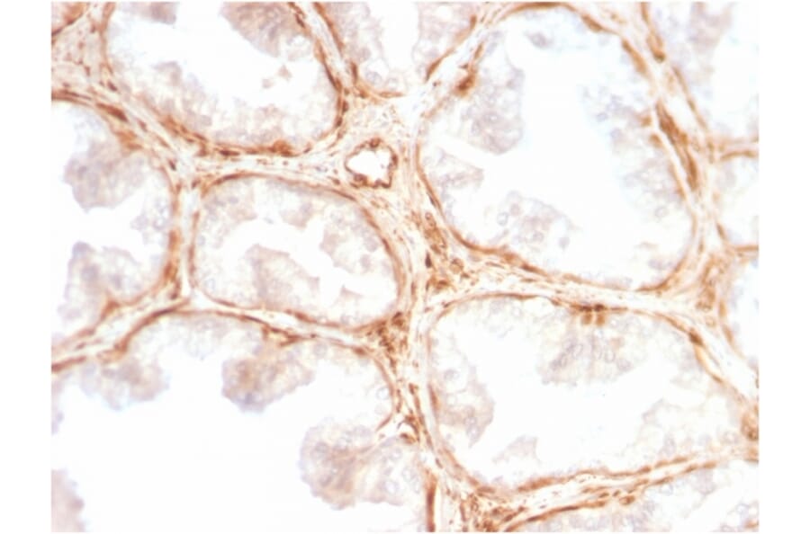 Immunohistochemistry - Anti-Galectin 1 Antibody [GAL1/2499R] (A249227) - Antibodies.com