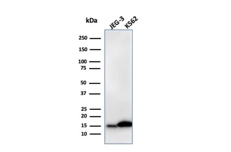 Western Blot - Anti-Galectin 1 Antibody [GAL1/2499R] (A249227) - Antibodies.com