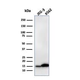 Western Blot - Anti-Galectin 1 Antibody [GAL1/2499R] (A249227) - Antibodies.com