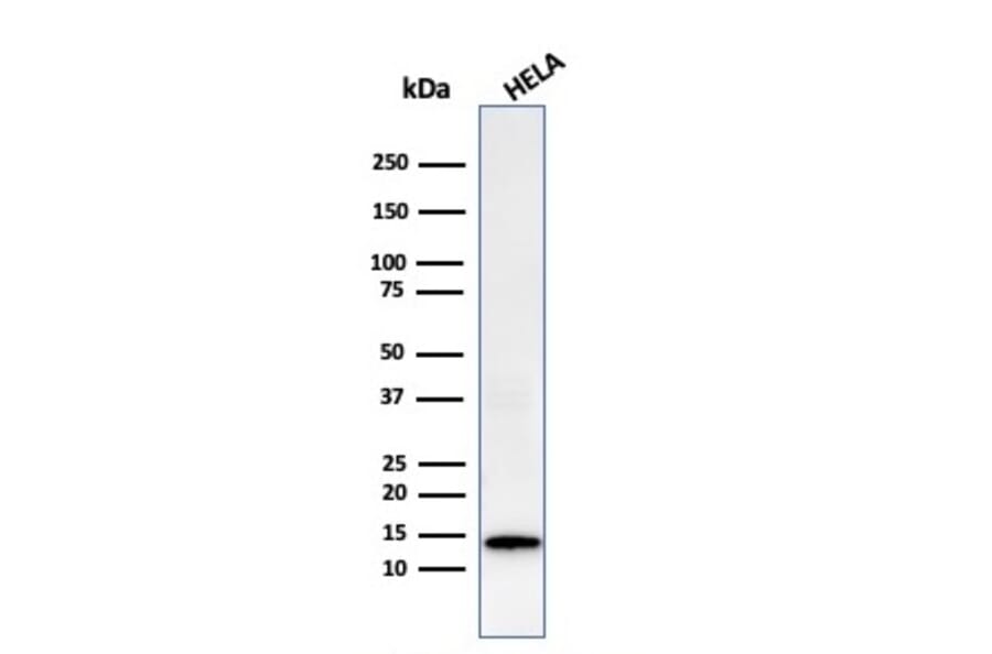 Western Blot - Anti-Galectin 1 Antibody [GAL1/2499R] (A249227) - Antibodies.com