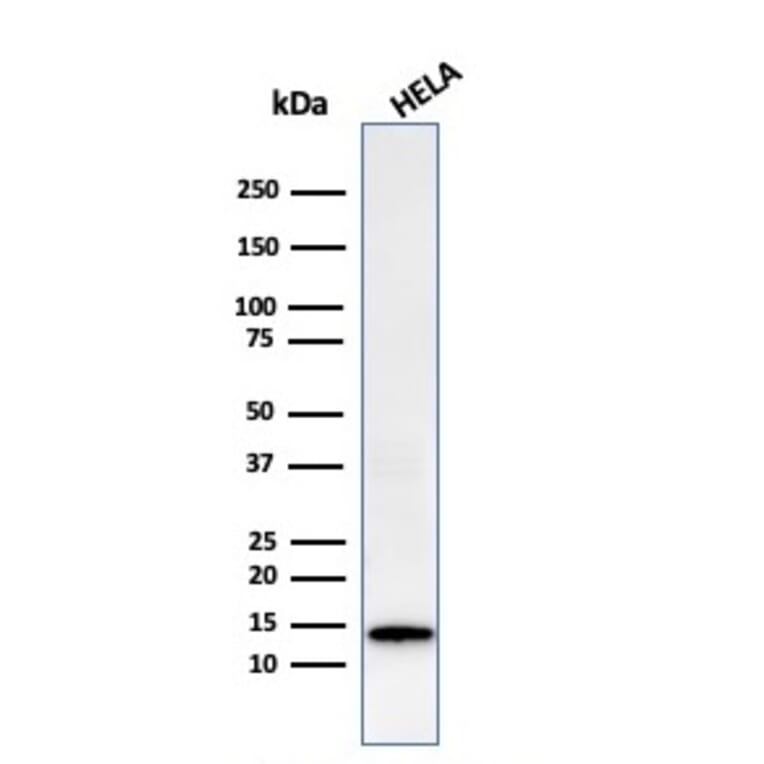 Western Blot - Anti-Galectin 1 Antibody [GAL1/2499R] (A249227) - Antibodies.com