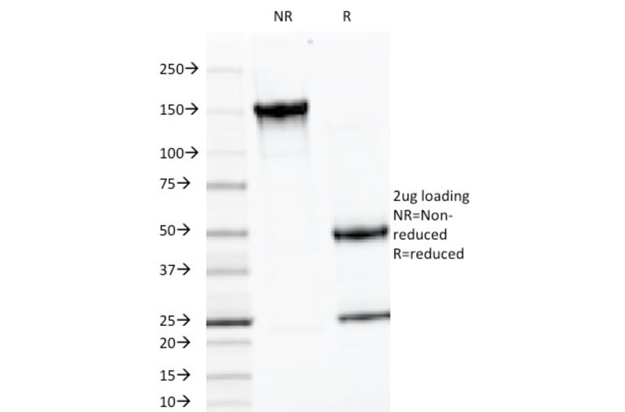 SDS-PAGE - Anti-Luteinizing Hormone beta Antibody [LHb/1214] (A249228) - Antibodies.com