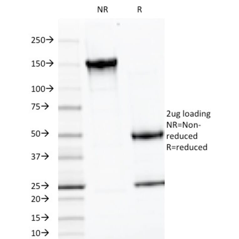 SDS-PAGE - Anti-Luteinizing Hormone beta Antibody [LHb/1214] (A249228) - Antibodies.com
