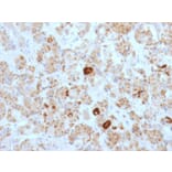 Immunohistochemistry - Anti-Luteinizing Hormone beta Antibody [SPM103] (A249228) - Antibodies.com
