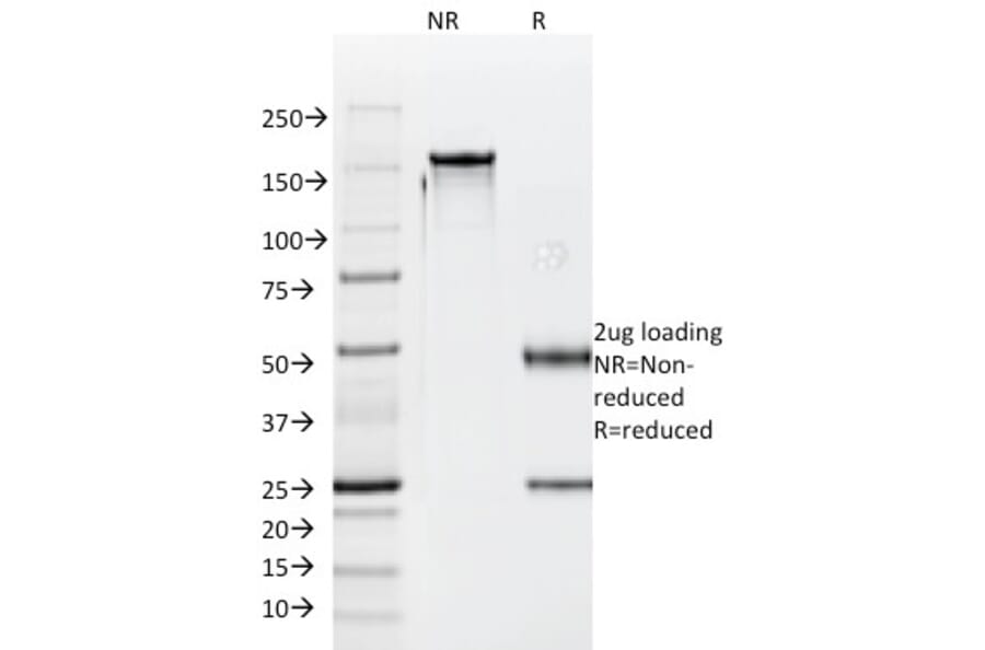 SDS-PAGE - Anti-Luteinizing Hormone beta Antibody [SPM103] (A249229) - Antibodies.com