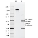 SDS-PAGE - Anti-Luteinizing Hormone beta Antibody [SPM103] (A249229) - Antibodies.com
