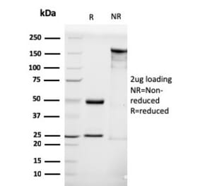 SDS-PAGE - Anti-Luteinizing Hormone Antibody [LHCGR/1416] (A249230) - Antibodies.com