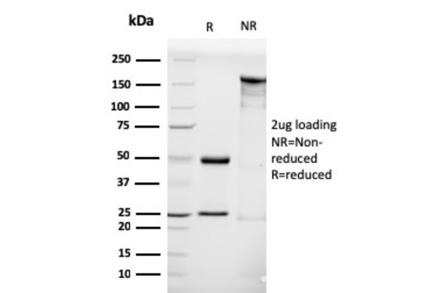 SDS-PAGE - Anti-Luteinizing Hormone Antibody [LHCGR/1416] (A249230) - Antibodies.com