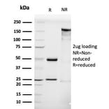 SDS-PAGE - Anti-Luteinizing Hormone Antibody [LHCGR/1416] (A249230) - Antibodies.com