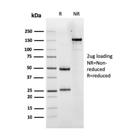 SDS-PAGE - Anti-Luteinizing Hormone Antibody [LHCGR/1417] (A249231) - Antibodies.com