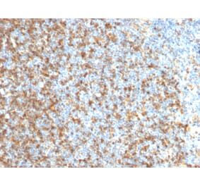 Immunohistochemistry - Anti-LMO2 Antibody [LMO2/1971] (A249234) - Antibodies.com