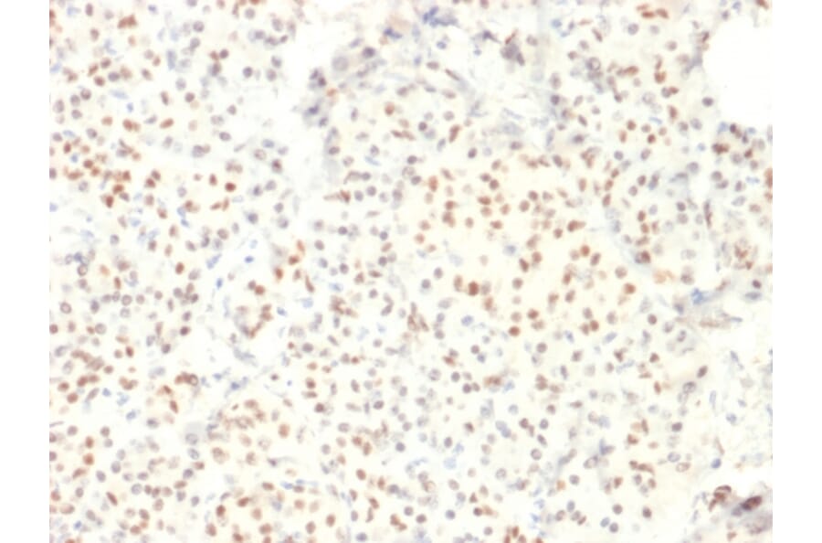 Immunohistochemistry - Anti-LMO2 Antibody [LMO2/1971] (A249234) - Antibodies.com