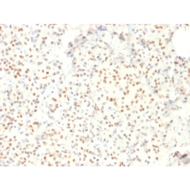 Immunohistochemistry - Anti-LMO2 Antibody [LMO2/1971] (A249234) - Antibodies.com