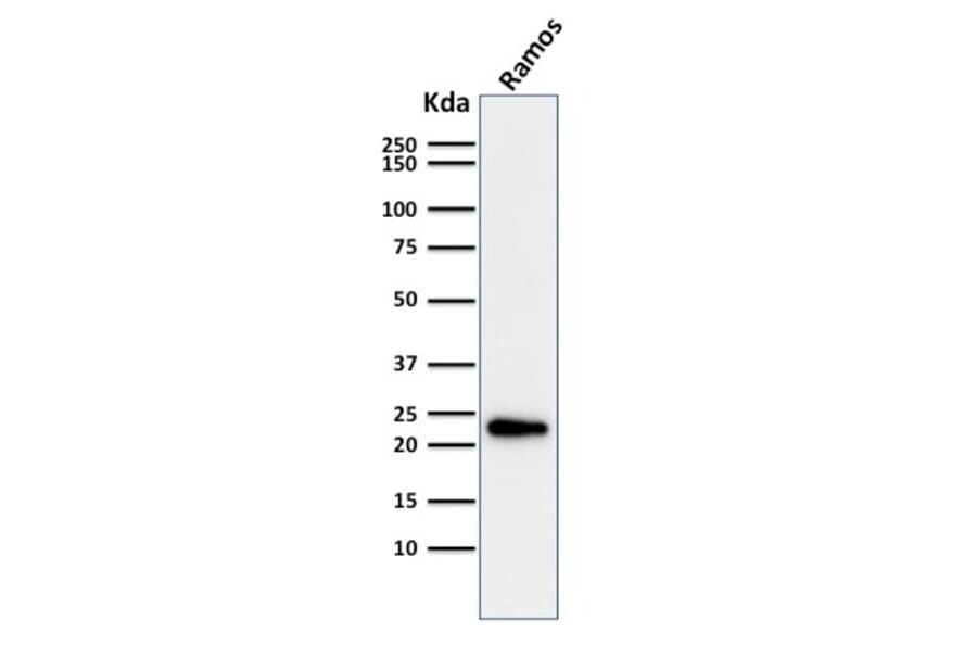 Western Blot - Anti-LMO2 Antibody [LMO2/1971] (A249234) - Antibodies.com