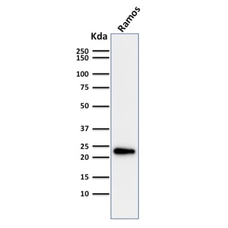 Western Blot - Anti-LMO2 Antibody [LMO2/1971] (A249234) - Antibodies.com