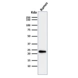 Western Blot - Anti-LMO2 Antibody [LMO2/1971] (A249234) - Antibodies.com