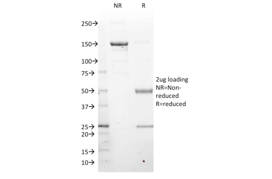 SDS-PAGE - Anti-LMO2 Antibody [LMO2/1971] (A249234) - Antibodies.com