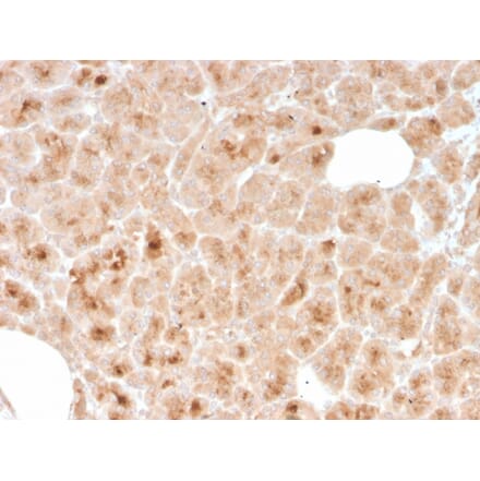 Immunohistochemistry - Anti-LMO2 Antibody [rLMO2/1971] (A249235) - Antibodies.com