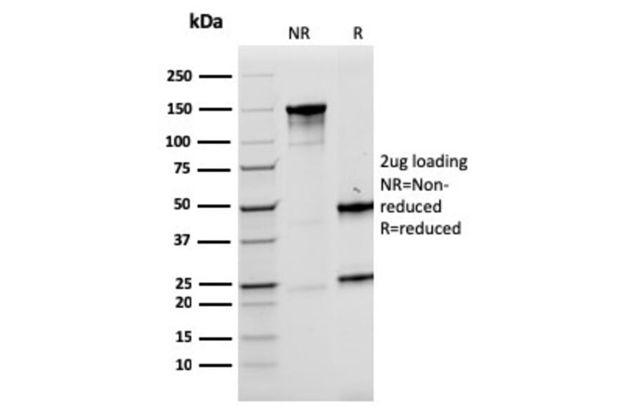 SDS-PAGE - Anti-LMO2 Antibody [rLMO2/1971] (A249235) - Antibodies.com