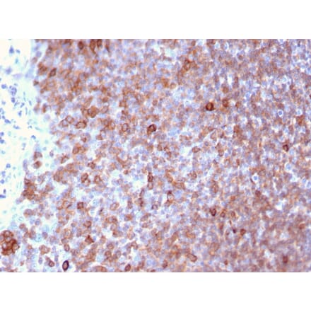 Immunohistochemistry - Anti-LSP1 Antibody [LSP1/3025] (A249237) - Antibodies.com