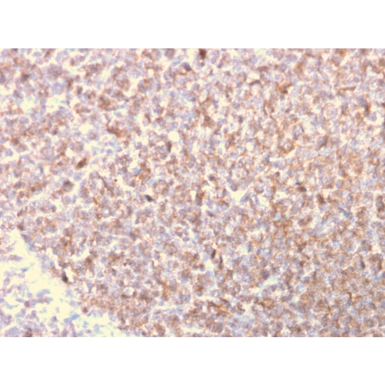 Immunohistochemistry - Anti-LSP1 Antibody [LSP1/3025] (A249237) - Antibodies.com