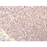 Immunohistochemistry - Anti-LSP1 Antibody [LSP1/3025] (A249237) - Antibodies.com