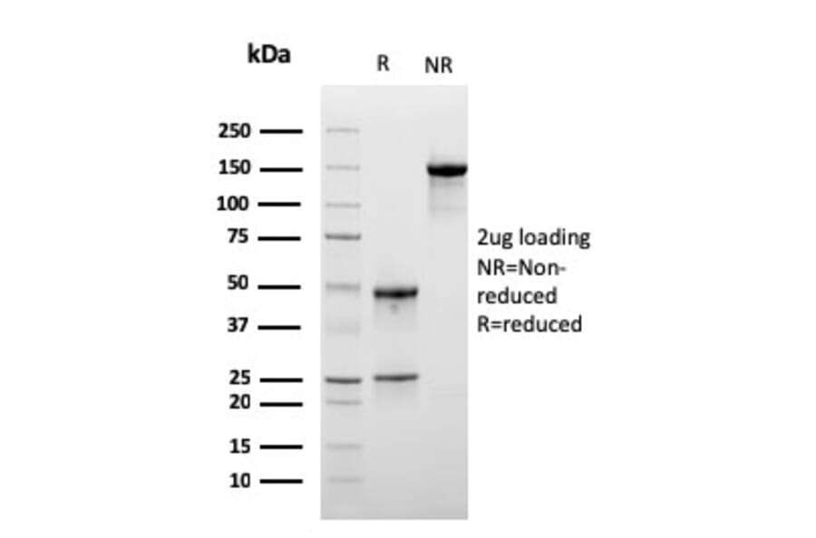 SDS-PAGE - Anti-LSP1 Antibody [LSP1/3025] (A249237) - Antibodies.com